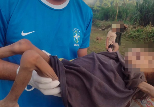 Homem carrega criança yanomami com desnutrição severa